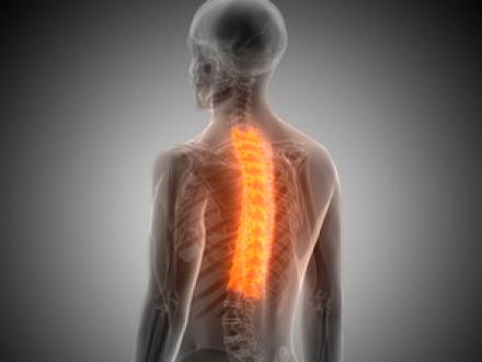 Springfield, IL Motorcycle Accident Attorneys